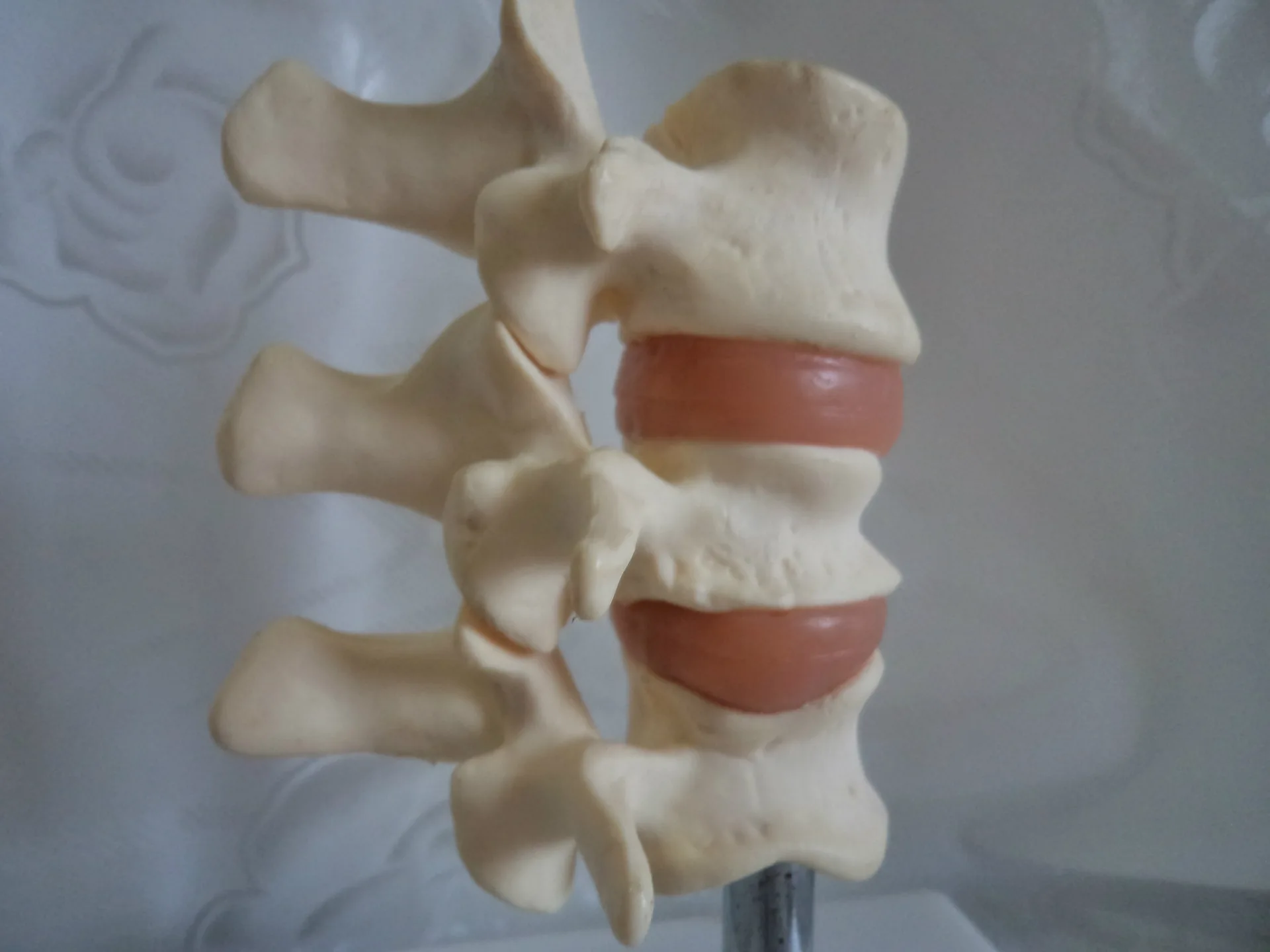 

Human anatomical spine Bone vegetable pine model Spinal typical lesion model skeleton toy