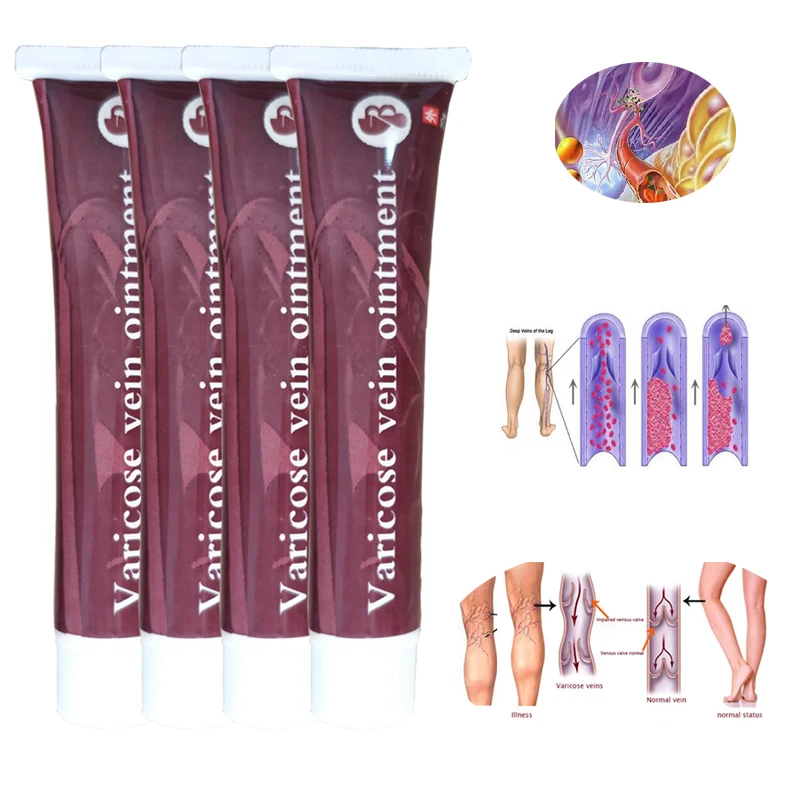 4 шт. сосудистых звездочек варикозное расширение обработка штукатурка вен