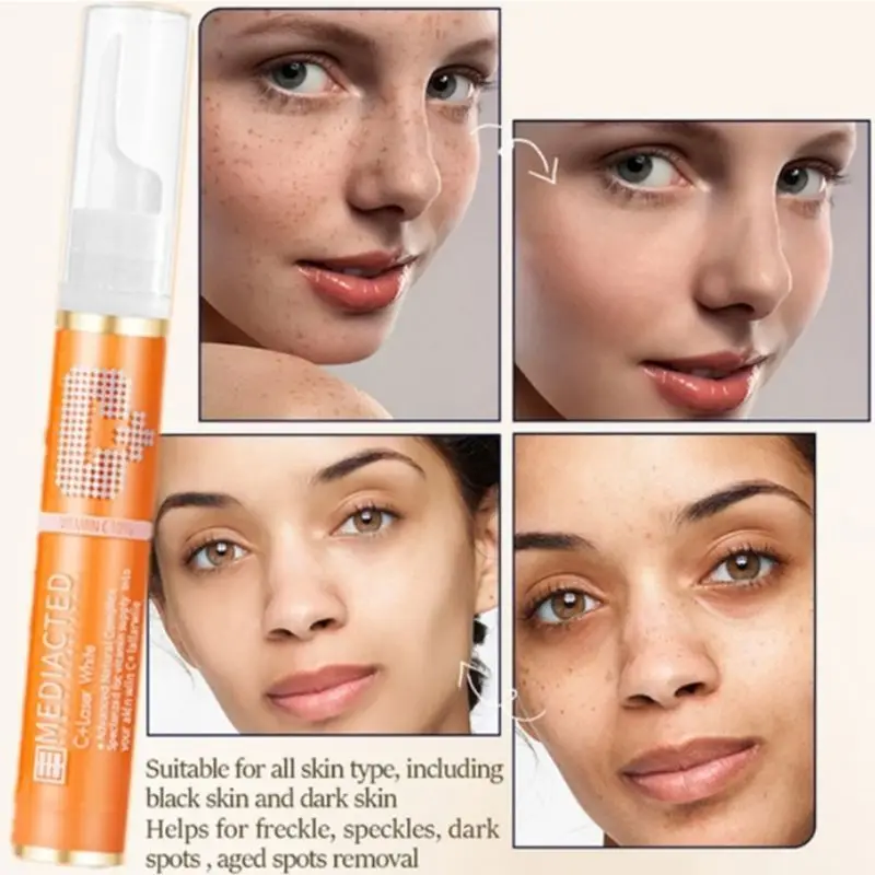 

15ml Vitamin C Frekle Cream Skin Repair Remove Dark Sports Pen Whitening Lotion U2JD