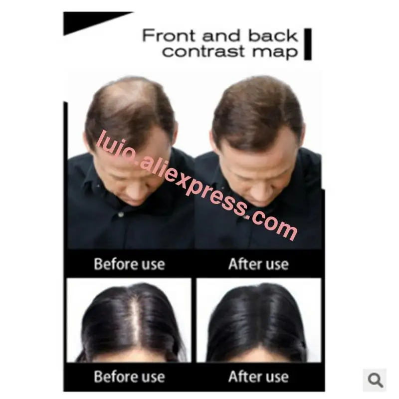 

Multi-colors Hair Loss Hair Building Fibers Hair Loss Concealer Thicken Powder Hair Care Product Growth Keratin Salon
