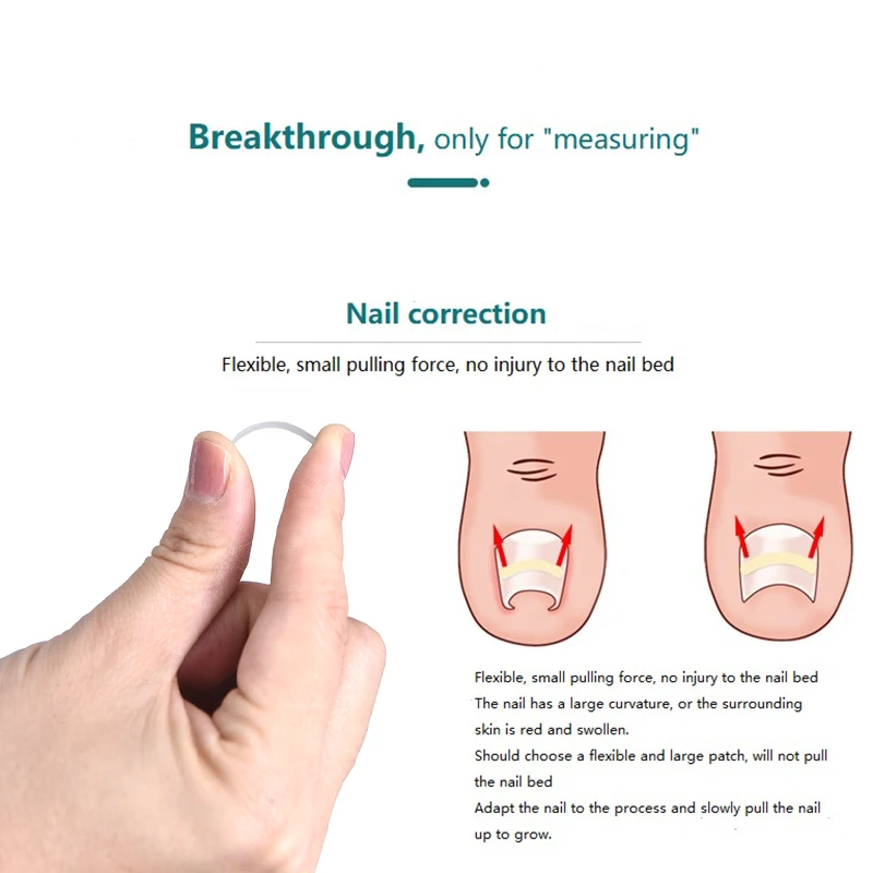 

10pcs Ingrown Toenail Straightening Clip Correction Paronychia Curved Feet Care Tool Toenail Straightening Clip