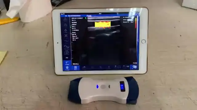 

192 Elements Wireless Color Doppler Double Head Convex and Linear