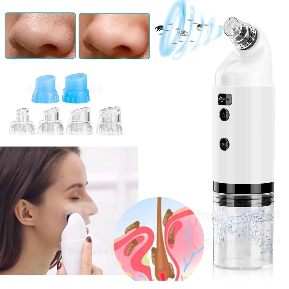Водородный кислорода Малый пузырьковый для удаления угрей светодиодный