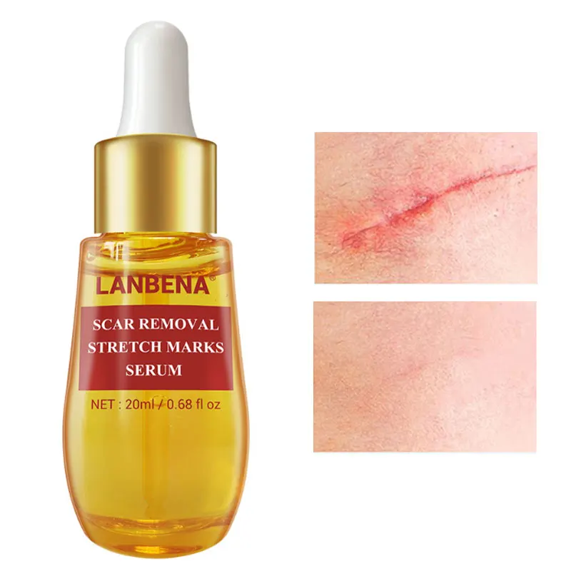 

Body Serum Remove Scar Vibration Lines Surgery Acne Pore Shrinkage Whitening Nourishing Firming Nicotinamide Skin Care 20ml