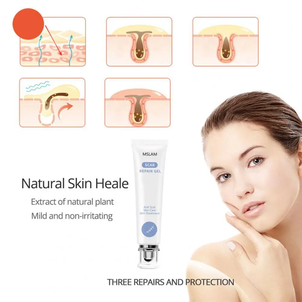

20ML Acne Mark Ointment Anti-allergic Mild Plant Extracts Acne Scar Removal Skin Repair Cream for Beauty