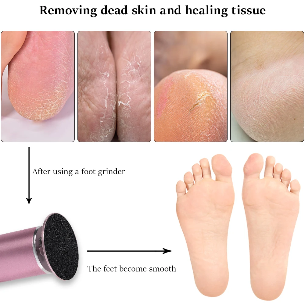 Electric Foot Grinder Heel File Grinding Exfoliator Pedicure Machine Dead Skin Callus Remover Feet Care Tools | Красота и здоровье