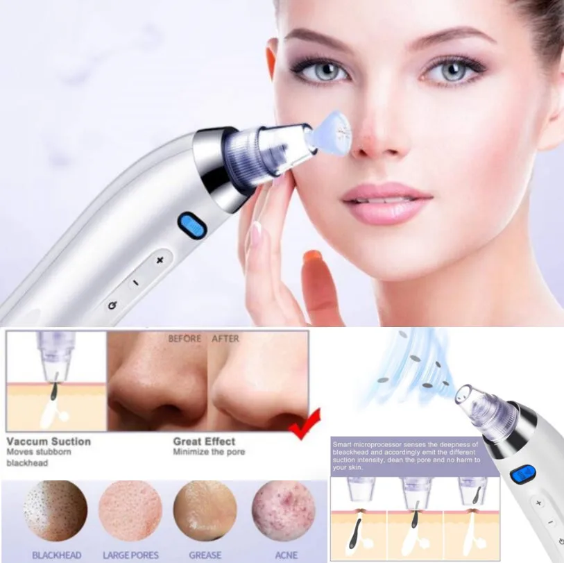 Уход за кожей пор и черных точек вакуумный удалитель акне Удаление прыщей