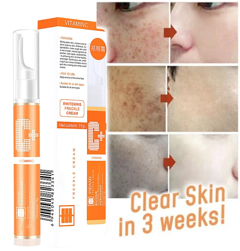 

15ml Vitamin C Blemish Removal Gel Whitening Anti Freckle Cream Pen Effective Remove The Freckle Pigmented Melanin Spots