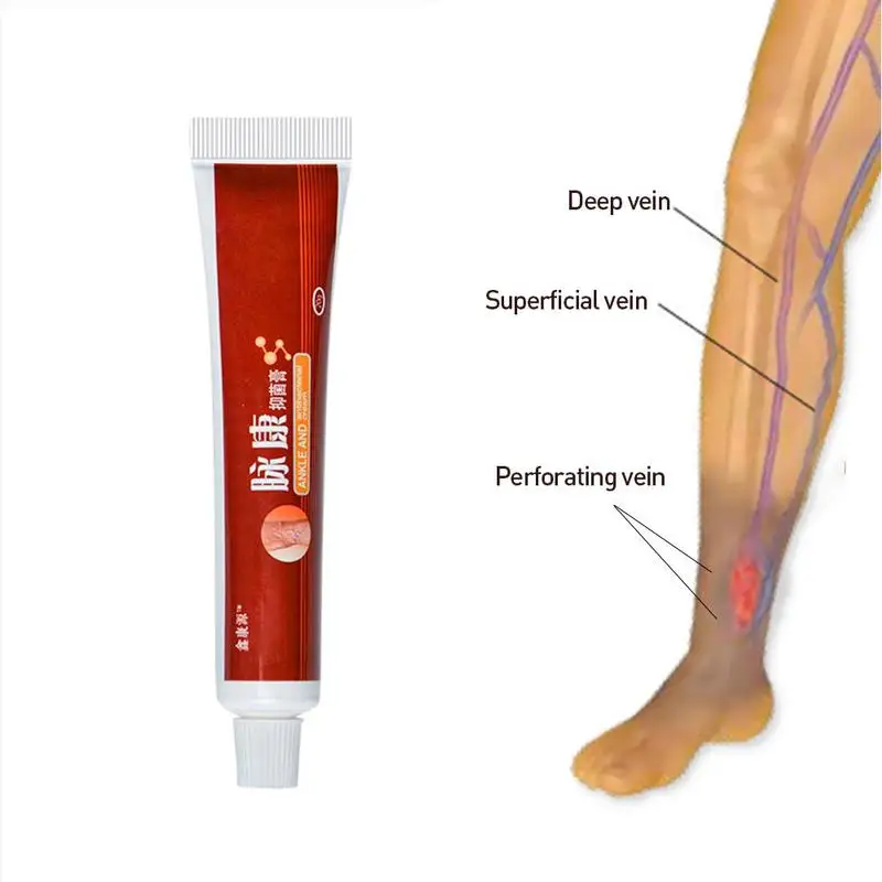 

1 Pc Varicose Veins Treatment Ointment Cream Treatment Phlebitis Legs Varicosity Angiitis Veins Pain Relief Remedy Health Care