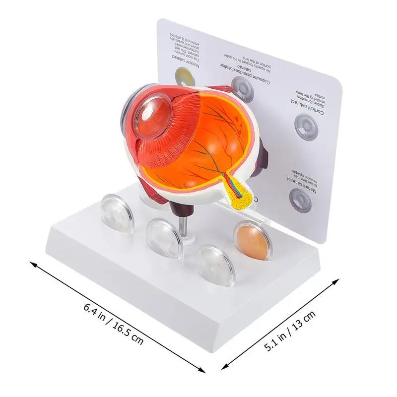 Демонстрационный набор для демонстрации болезни глаз от роговицы | Канцтовары