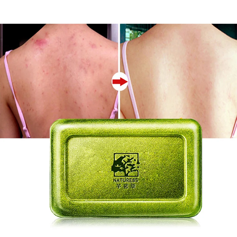 WXE зеленое мыло контроль выработки кожного жира лечение акне угорь 120 г