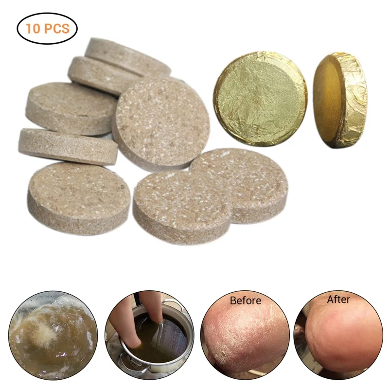 10 шт. имбиря стопы шипучие Планшеты способствует метаболизму предупреждения