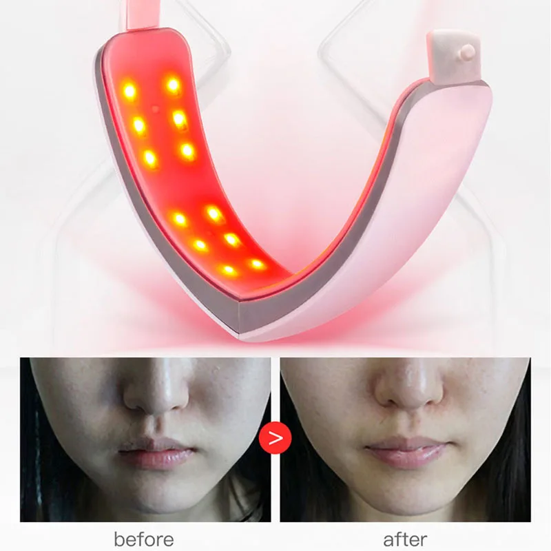 Электрический V Пояс для подтяжки лица стройнящий массажер формирователь LED