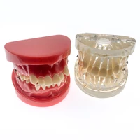 teeth model dentist orthodontic tooth model demonstration teaching doctor patient research model for dentistry students