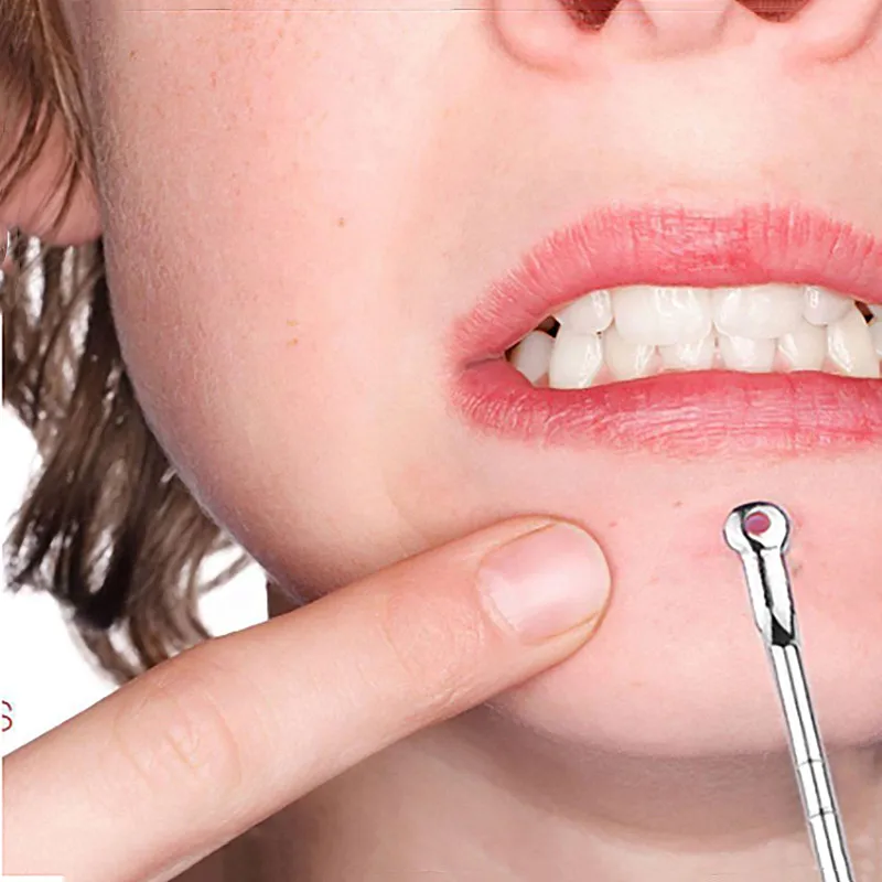 

Иглы для удаления чёрных точек и прыщей на лице