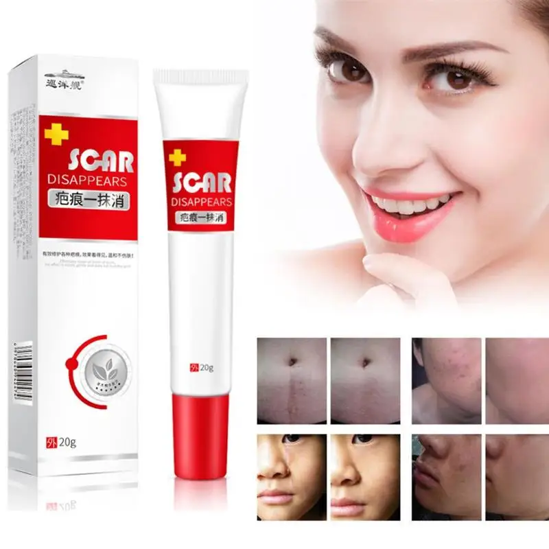 20ml Scar Treatment Cream Whitening Cream Skin Repair Repair Scar Treatment Face Stretch Acne Cream Cream A8X8