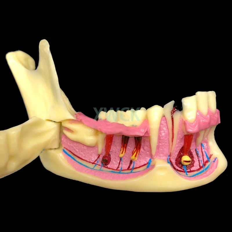 1 шт. модель для обучения стоматологии