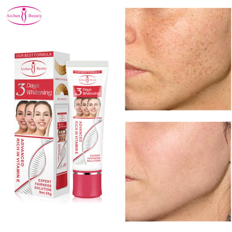 

3 Days Whitening Face Nicotinamide Freckle Removal Cream Improve Dullness Anti Wrinkle Remove Dark Spot Fast Whiten Skin Care