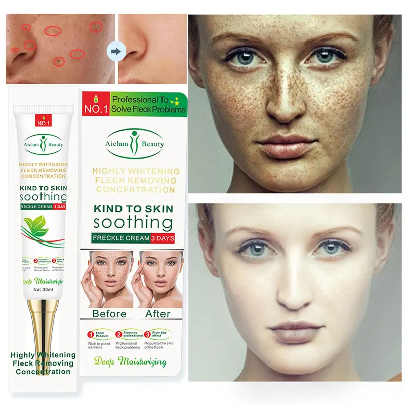 

Effective Whitening Freckle Cream 30g Remove Melasma Acne Spot Pigment Melanin Dark Spots Whitening Moisturizing Cream Skin Care