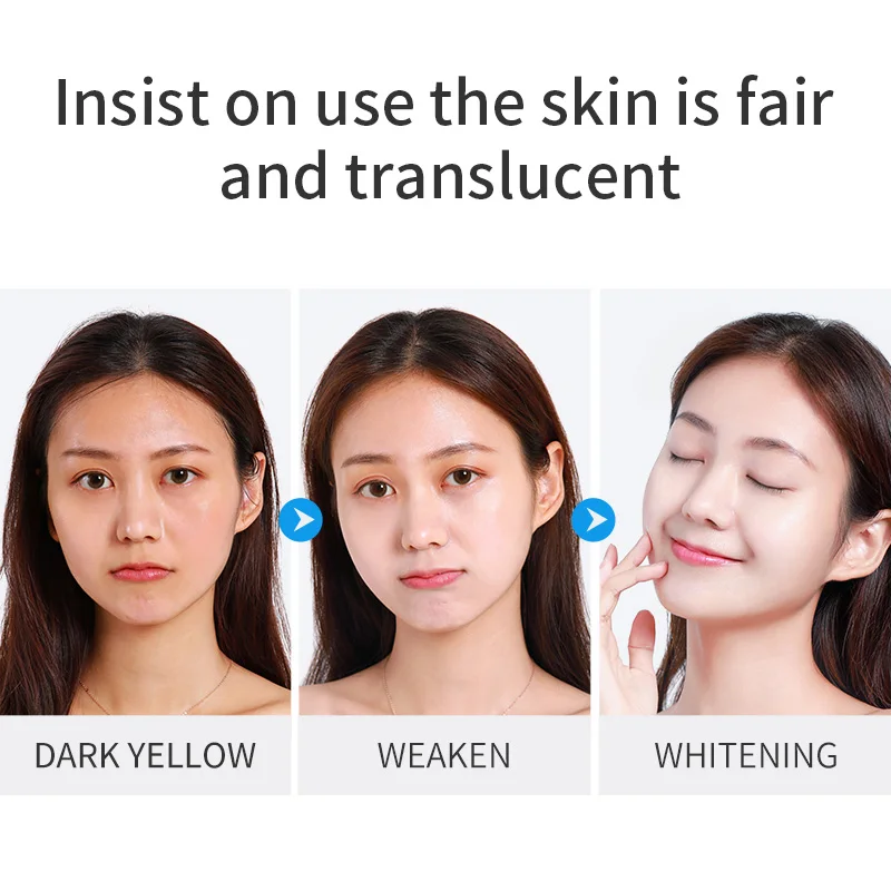 SHVYOG отбеливающий никотинамид набор для ухода за кожей лица очищающий крем лосьон