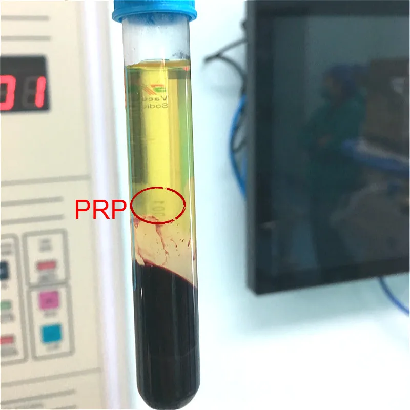 Стерильный вакуумный тюбик для забора крови 8 мл контейнер с цитратом натрия и