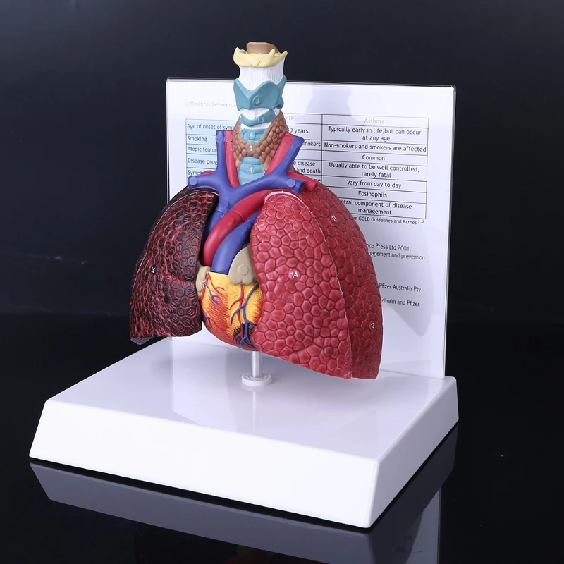 

Модель легких человека в натуральную величину, анатомическая дыхательная система, инструмент для обучения анатомии 24 шара