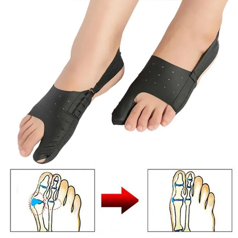 1 шт. разделитель для большого пальца ноги при вальгусной деформации | Красота и