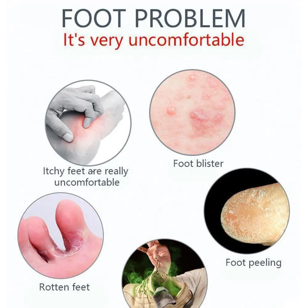 

1Pcs Beriberi Treatment Ointment Athlete's Foot Erosive Anti Itching Foot Cream Sweat Odor Psoriasis Antibacterial Feet Care