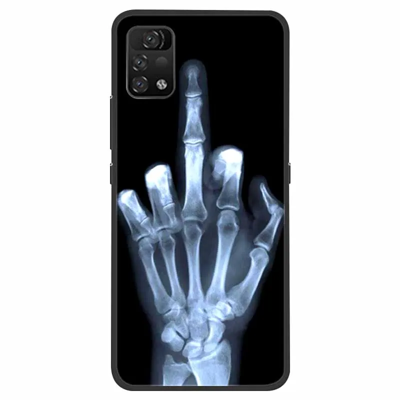 for umidigi a11 pro max case shockproof soft silicone tpu back cover for umidigi a11 pro max phone cases umidigi a11pro max 2021 free global shipping