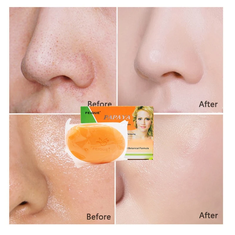 Натуральная растительная формула отбеливающий с экстрактом папайи анти