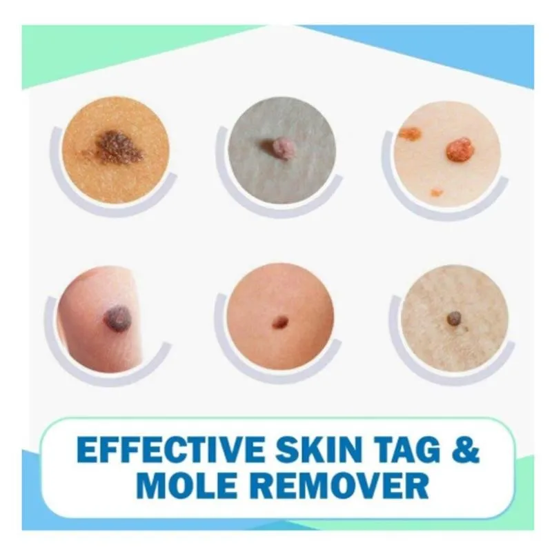 

3ml Clear Moles & Tag Wiper Wipeoff Tags Genital Wart Pen Wart Moles Treatment Removal Liquid Remover Z9U6