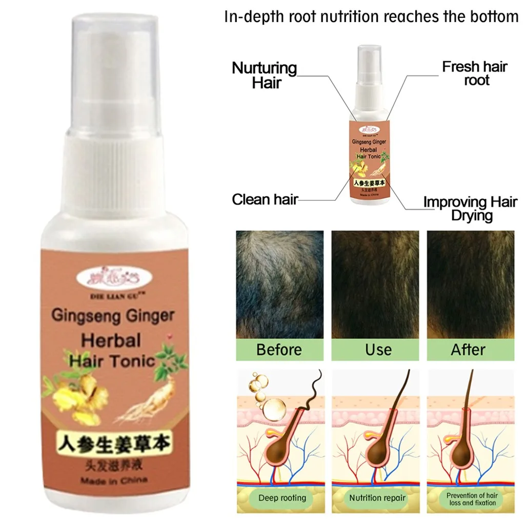 Спрей для роста волос имбирный женьшень сыворотка лечения выпадения волос|Масла