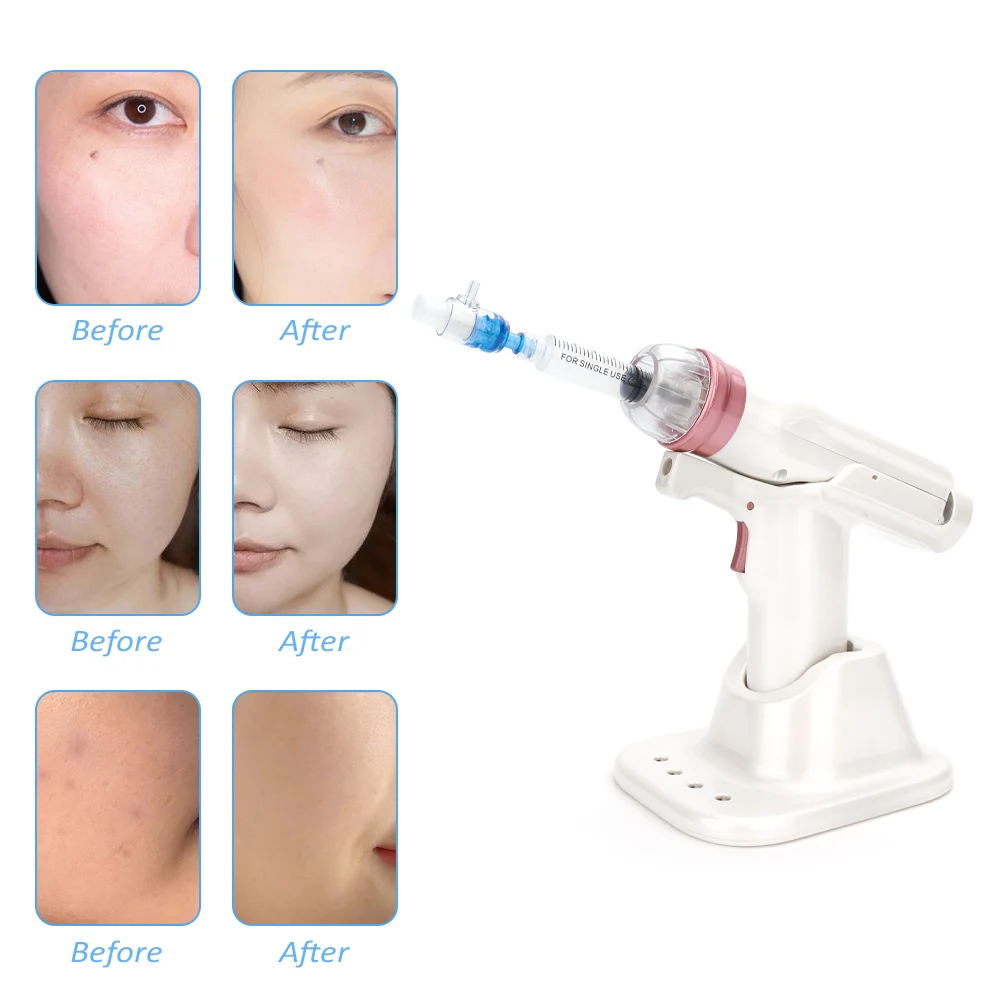 Water Injector Mesotherapy Negative Pressure Meso Gun Mesotherapy Gun Hydrolifting Moisturizing Beauty Device Skin Care Tool