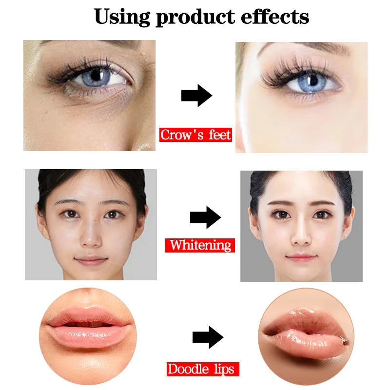 

0.3ml&0.5ml 2in 1 Meso Injection Gun Hyaluron Pen Head Gold Hyaluronic Acid Pen for Lip Filler Injector Anti Wrinkle Lip Lift