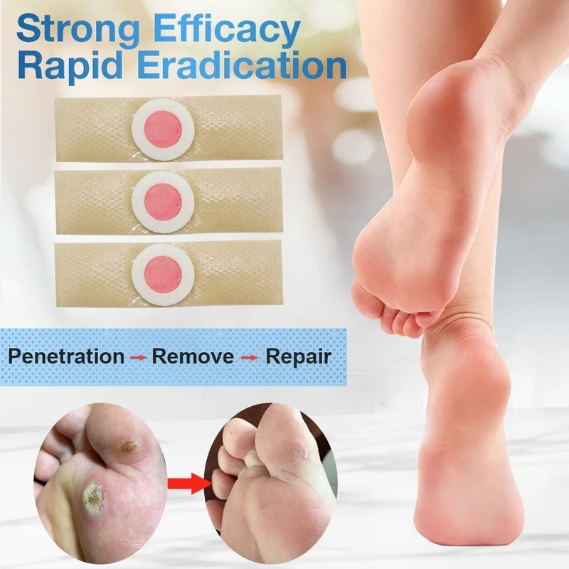 

24Pcs Foot Care Sticker Medical Patch Corn Removal Pads Warts Thorn Curative Patches Calluses Remove Callosity Detox
