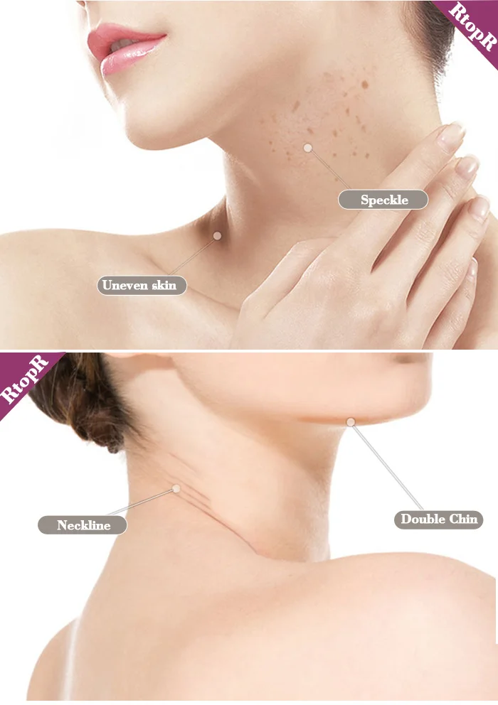 40 г оптовая продажа подтяжка кожи шеи омоложения крем против морщин укрепляющий