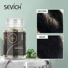 Sevich 30 шт., масляный комплекс для роста волос, средство против выпадения волос, кератин, восстановление поврежденных волос, Имбирная сыворотка, капсулы для роста волос