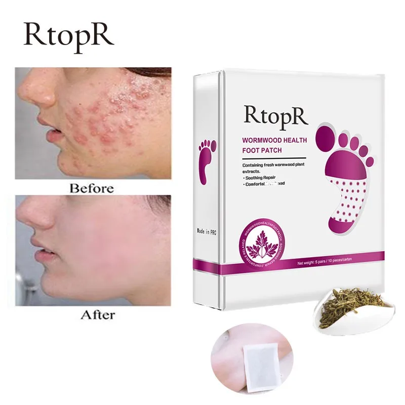 10 шт./пакет потеря веса детоксикация подушечки для похудения детоксикации