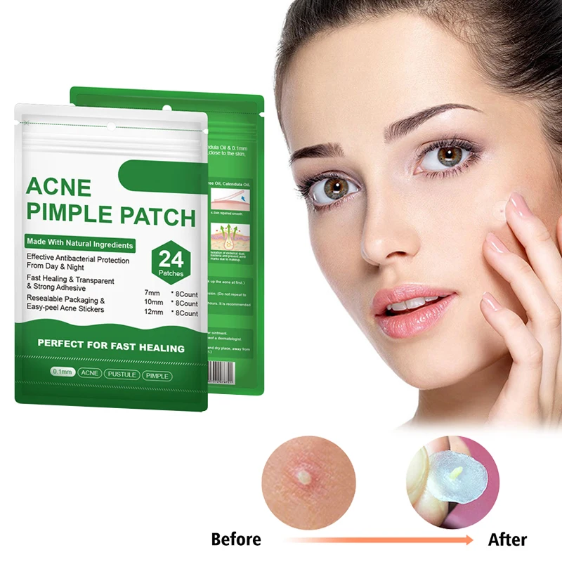 24 шт./упак. акне прыщи патч Невидимый наклейки от угревой сыпи Whelk терапии