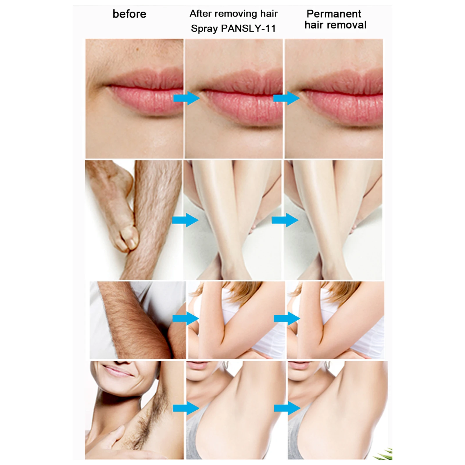 

Hair Inhibitor, Hair Removal Spray, Stop Hair Growth, Hair Inhibiting And