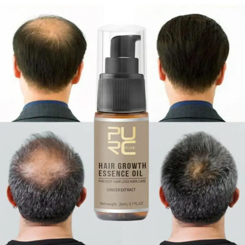 

20ml Fast Hair Growth Fluid Anti Hair Loss Ginseng Supple Hair Hair Growth Scalp Treatment Healthy Natural Nourish U2N0