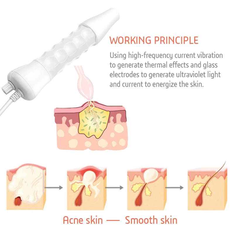 Модернизированный высокочастотный прибор для тока палочки электротерапии
