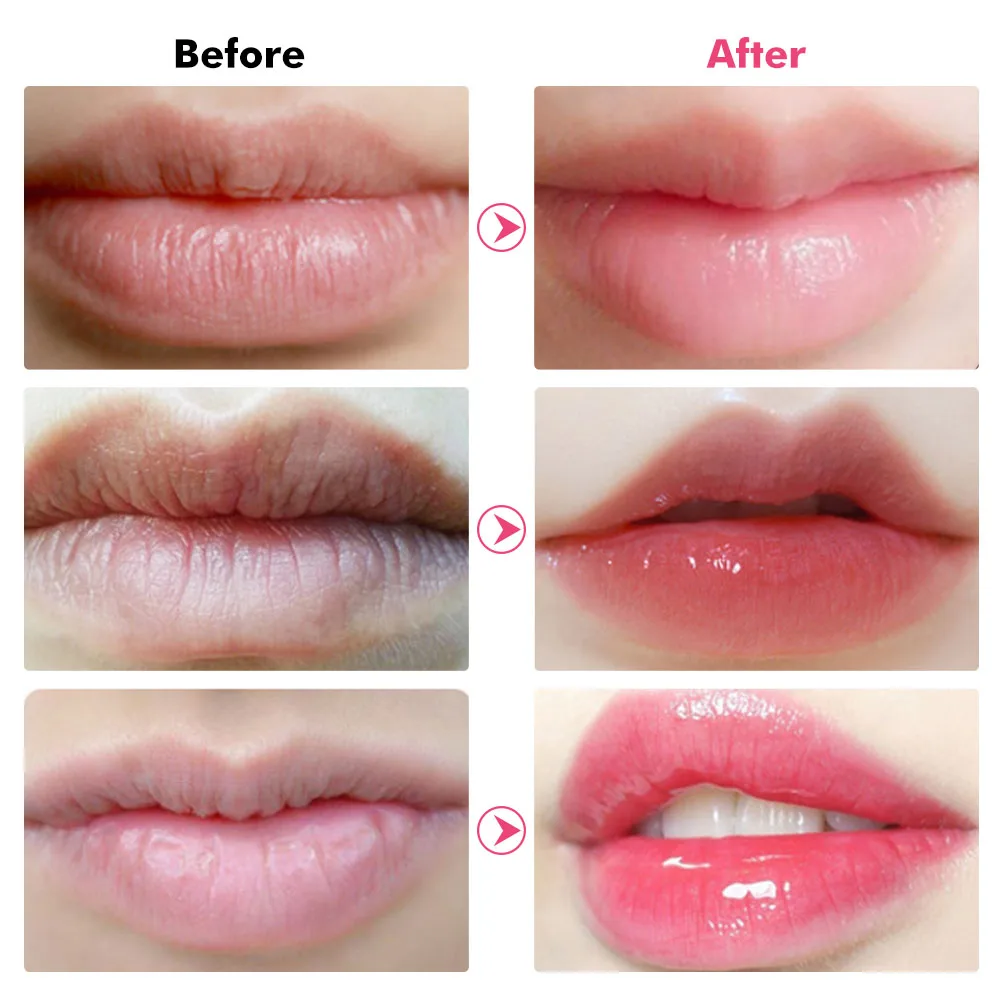 10 шт. коллагеновая маска для губ с розовыми кристаллами |