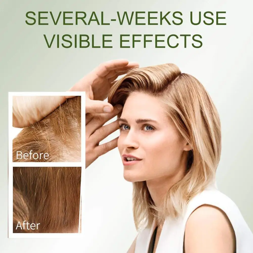 100% Уход За Волосами Эфирные масла для роста волос оригинальная эссенция