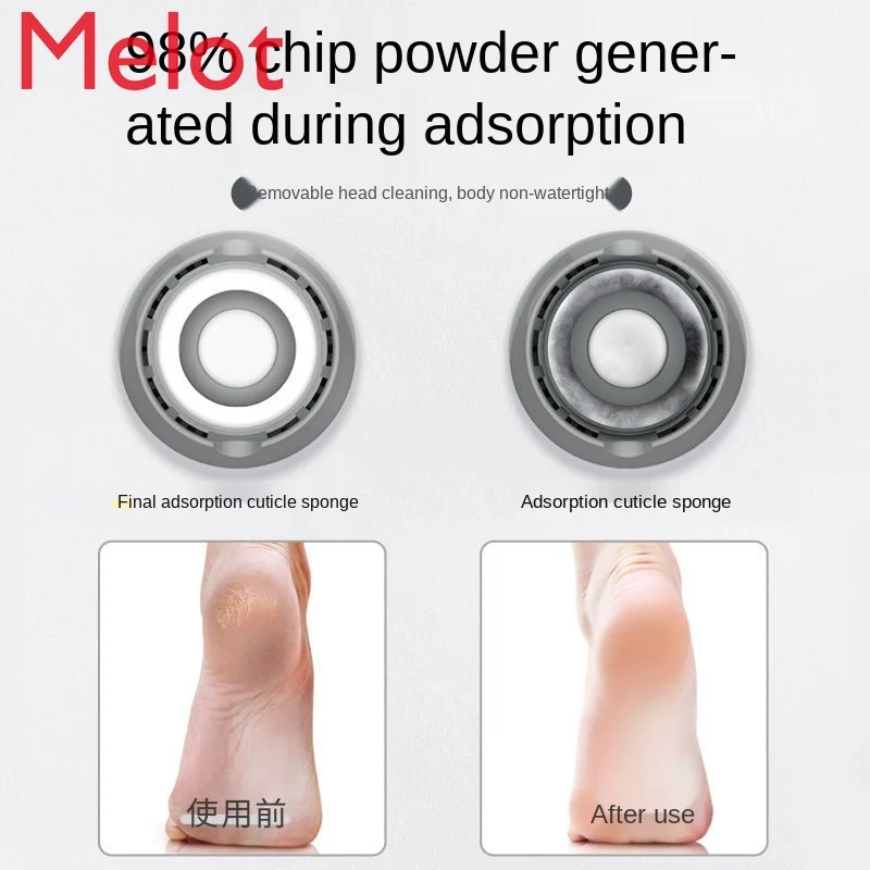 

Luxury Electric Foot Grinder Pedicure Device Automatic Foot Grinding Get Rid of Foot Skin Pedicure Device Home Modern Foot Care