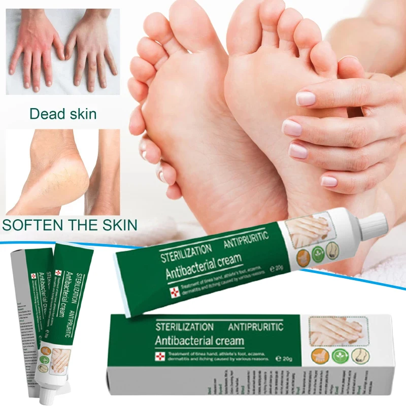 

20 г травяная мазь идеально подходит для экземы Tinea для рук и лечения ног Крем для наружного применения анти-зуд штукатурка крем