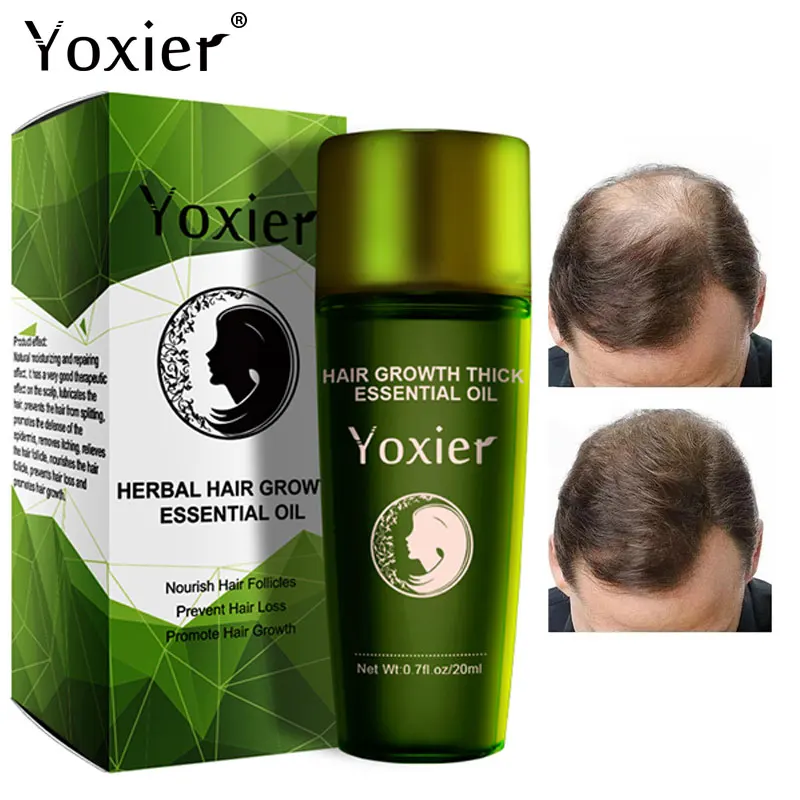 Эффективное средство для быстрого роста кожи головы увлажняющее против