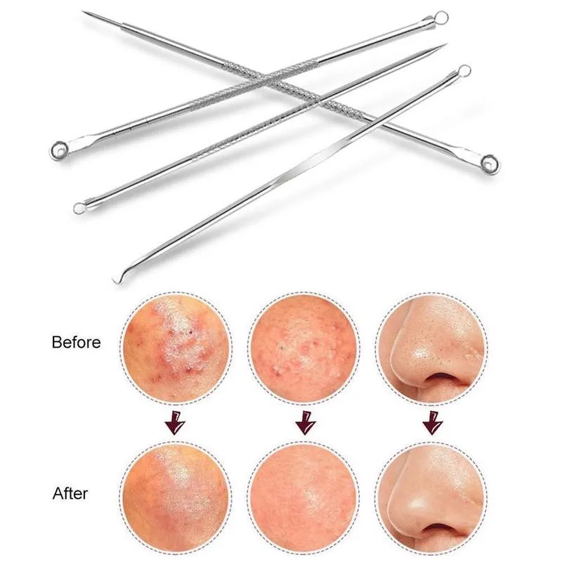 4 шт. раздавить черных точек иглы золотистый и черный горошек акне очиститель для
