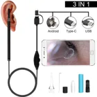 Медицинская ложка-эндоскоп для чистки ушей, мини-камера для извлечения ушей и воска, отоскоп с визуальным изображением уха, рта, носа, с поддержкой Android и ПК