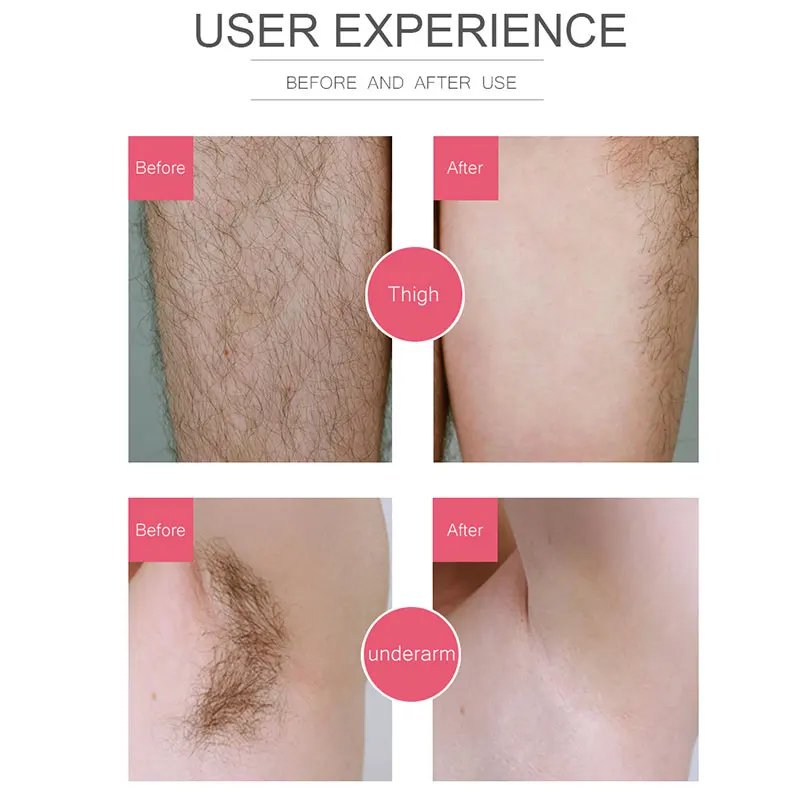 100 г Цветочный Сладкий роликовый эпиляционный воск полоски для удаления волос